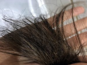 Plaukų galiukų skilinėjimas