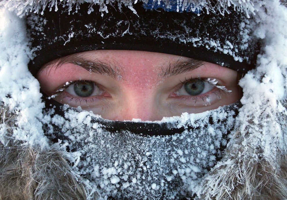 Kaip prižiūrėti odą žiemą