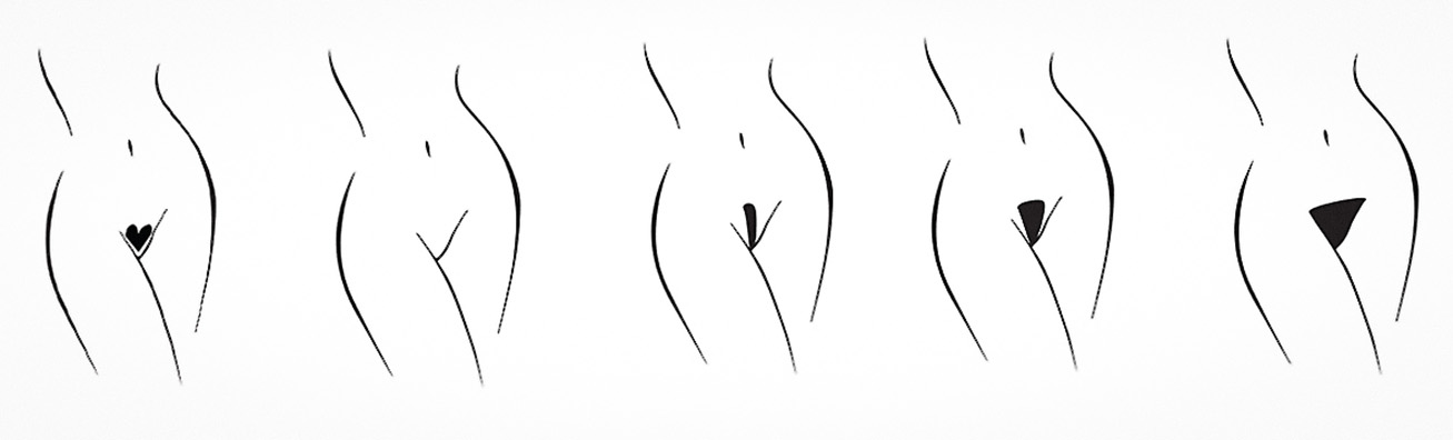 Bikini depiliacijos formos