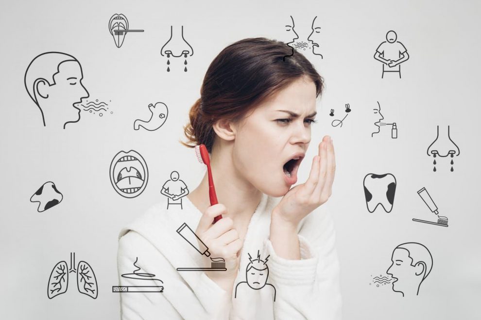 Kaip panaikinti blogą kvapą iš burnos